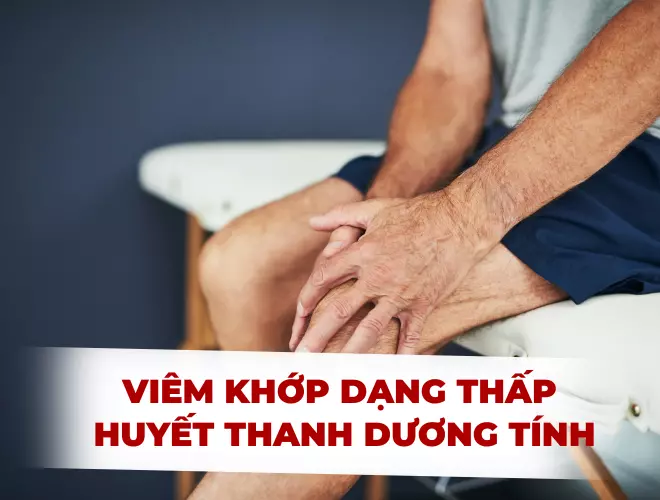 Viêm khớp dạng thấp huyết thanh dương tính: Hiểu để điều trị hiệu quả 